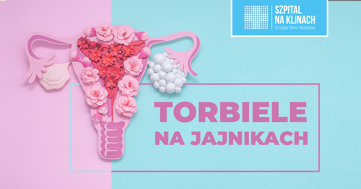 Torbiele Na Jajnikach – Czym Są, Jakie Dają Objawy I Jak Się Je Leczy?